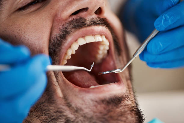 Best Urgent Tooth Repair  in Pleasanton, KS